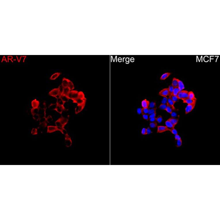 Immunofluorescence - Anti-Androgen Receptor Antibody (A329116) - Antibodies.com