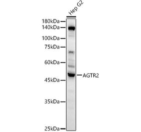 Western Blot - Anti-Angiotensin II Type 2 Receptor Antibody (A329118) - Antibodies.com