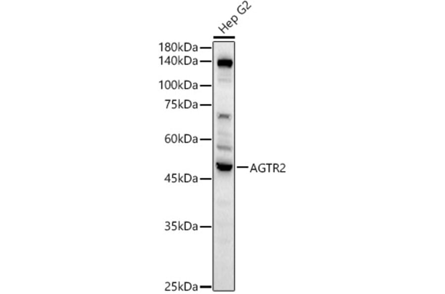 Western Blot - Anti-Angiotensin II Type 2 Receptor Antibody (A329118) - Antibodies.com