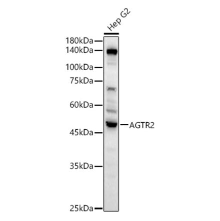 Western Blot - Anti-Angiotensin II Type 2 Receptor Antibody (A329118) - Antibodies.com