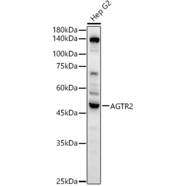 Western Blot - Anti-Angiotensin II Type 2 Receptor Antibody (A329118) - Antibodies.com