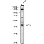 Western Blot - Anti-Angiotensin II Type 2 Receptor Antibody (A329118) - Antibodies.com