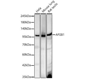 Western Blot - Anti-AP2B1 Antibody [ARC61904] (A329119) - Antibodies.com