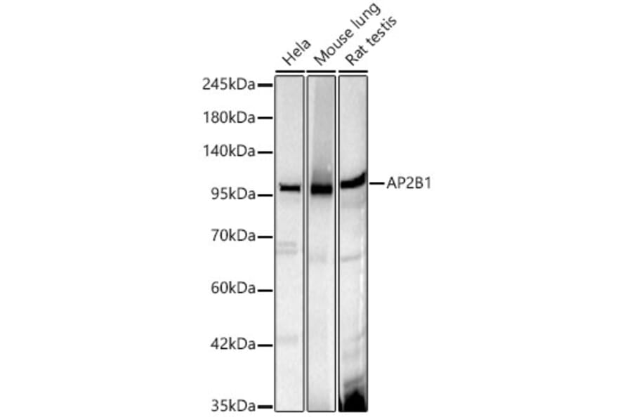 Western Blot - Anti-AP2B1 Antibody [ARC61904] (A329119) - Antibodies.com