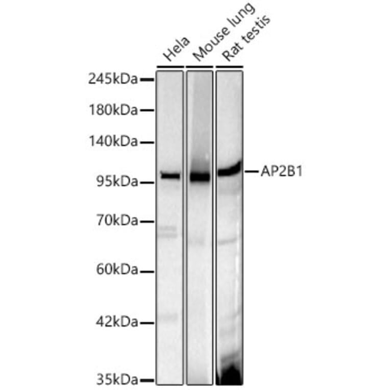 Western Blot - Anti-AP2B1 Antibody [ARC61904] (A329119) - Antibodies.com