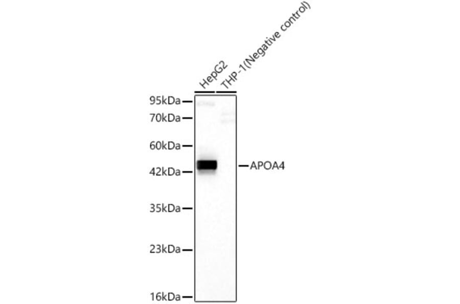 Western Blot - Anti-APOA4 Antibody [ARC62234] (A329120) - Antibodies.com