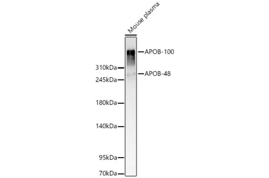 Western Blot - Anti-APOB Antibody (A329123) - Antibodies.com