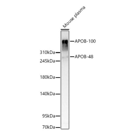 Western Blot - Anti-APOB Antibody (A329123) - Antibodies.com