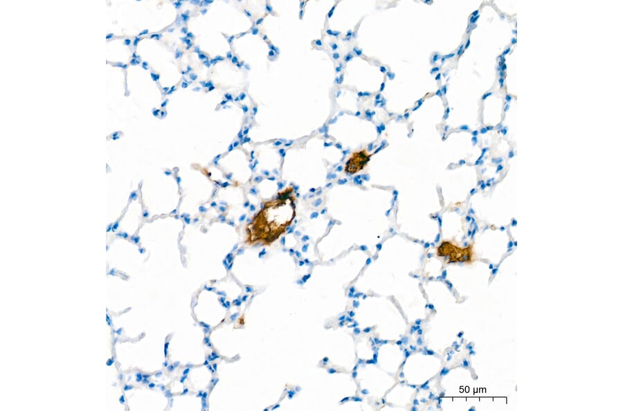 Immunohistochemistry - Anti-APOB Antibody (A329123) - Antibodies.com