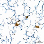 Immunohistochemistry - Anti-APOB Antibody (A329123) - Antibodies.com