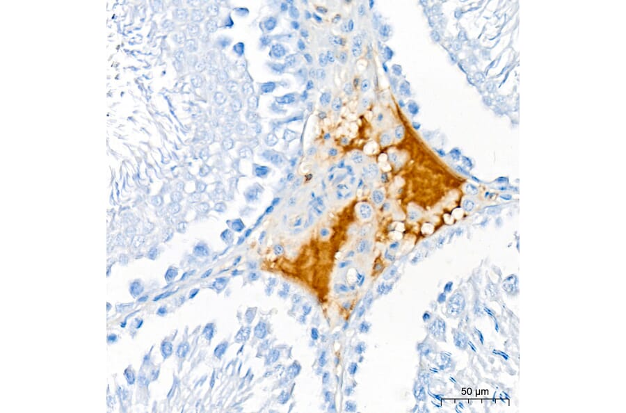 Immunohistochemistry - Anti-APOB Antibody (A329123) - Antibodies.com