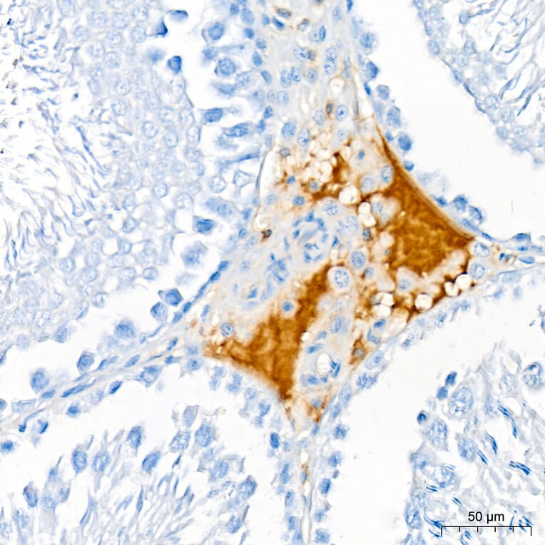 Immunohistochemistry - Anti-APOB Antibody (A329123) - Antibodies.com