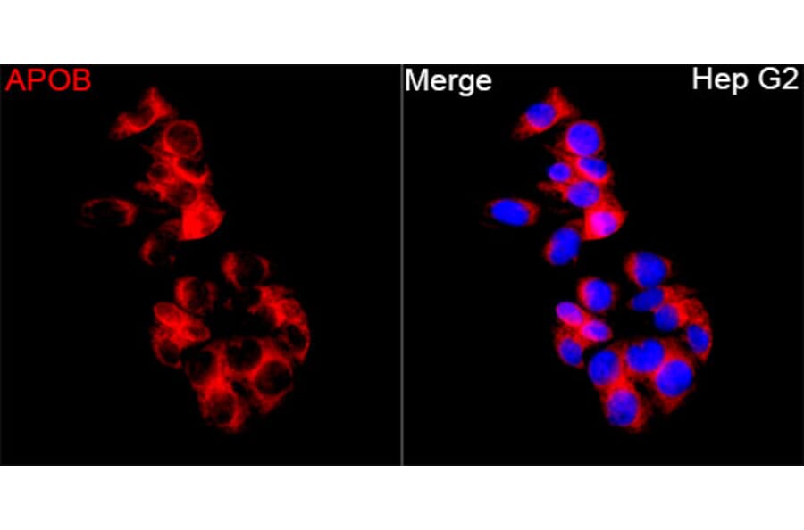 Immunofluorescence - Anti-APOB Antibody (A329123) - Antibodies.com