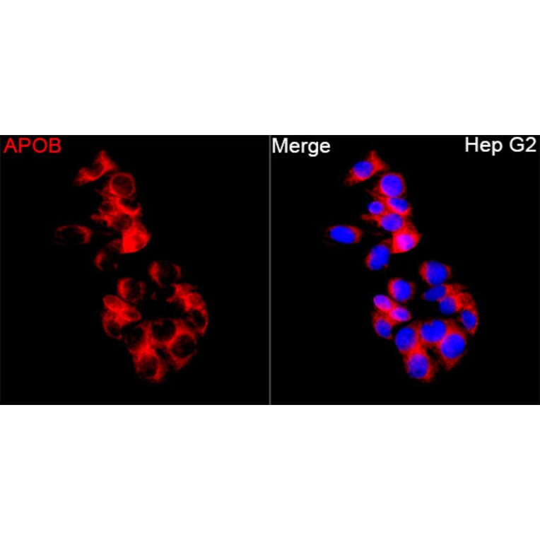 Immunofluorescence - Anti-APOB Antibody (A329123) - Antibodies.com