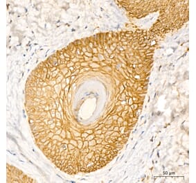 Immunohistochemistry - Anti-Aquaporin 3 Antibody (A329124) - Antibodies.com