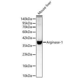 Western Blot - Anti-Arginase 1 Antibody (A329125) - Antibodies.com