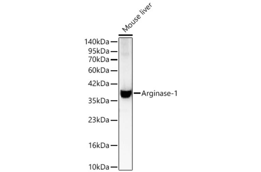 Western Blot - Anti-Arginase 1 Antibody (A329125) - Antibodies.com
