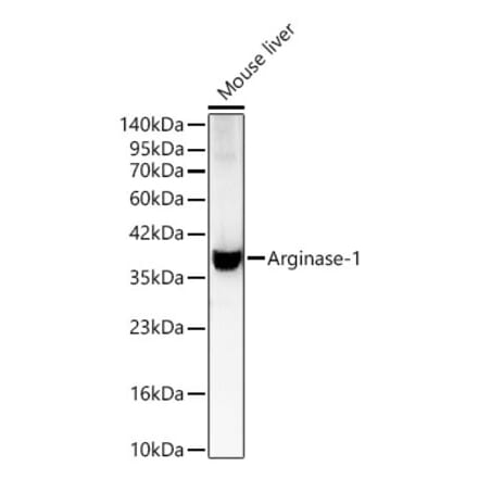 Western Blot - Anti-Arginase 1 Antibody (A329125) - Antibodies.com
