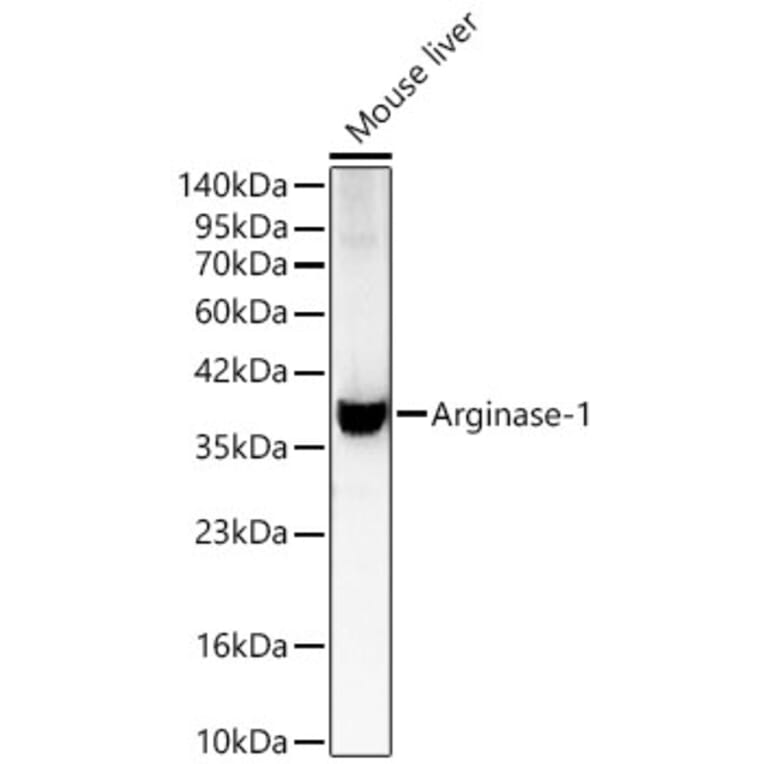 Western Blot - Anti-Arginase 1 Antibody (A329125) - Antibodies.com
