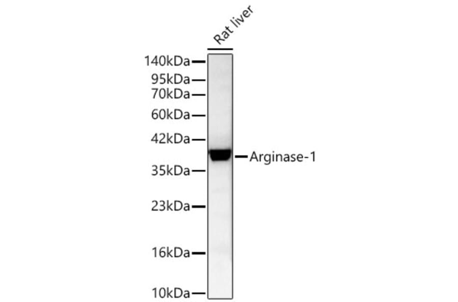 Western Blot - Anti-Arginase 1 Antibody (A329125) - Antibodies.com