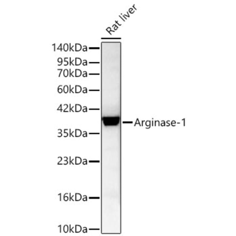 Western Blot - Anti-Arginase 1 Antibody (A329125) - Antibodies.com