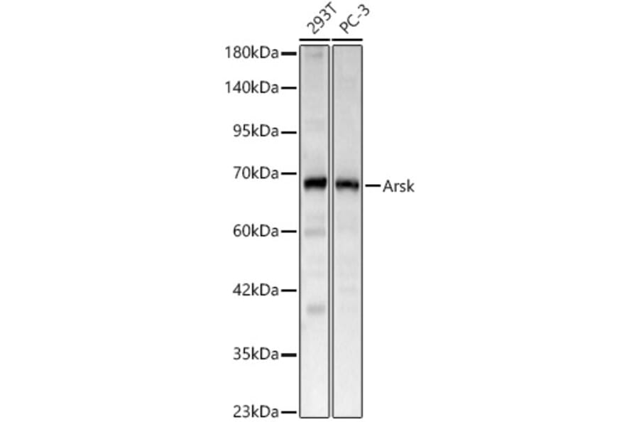 Western Blot - Anti-Arsk Antibody (A329127) - Antibodies.com