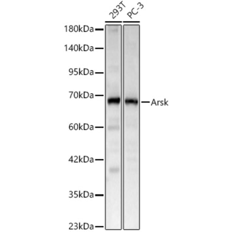 Western Blot - Anti-Arsk Antibody (A329127) - Antibodies.com