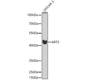Western Blot - Anti-ART3 Antibody (A329128) - Antibodies.com