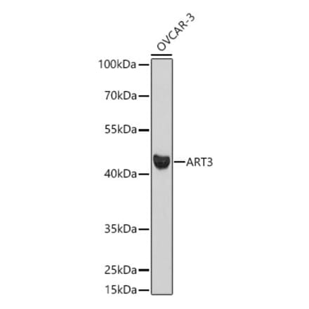 Western Blot - Anti-ART3 Antibody (A329128) - Antibodies.com