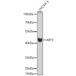 Western Blot - Anti-ART3 Antibody (A329128) - Antibodies.com