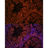 Immunofluorescence - Anti-ART3 Antibody (A329128) - Antibodies.com