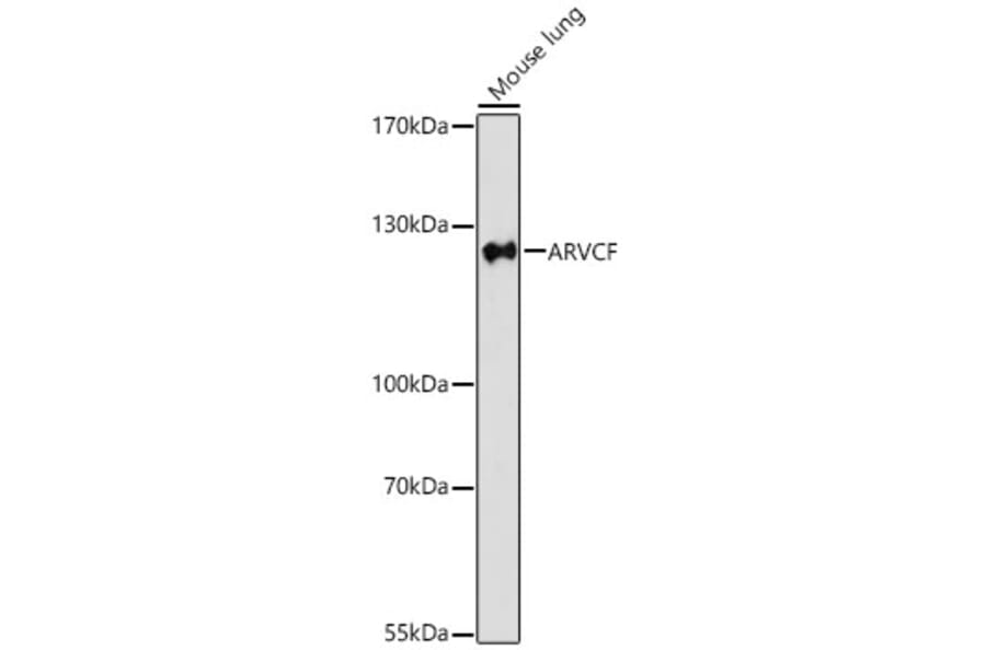 Western Blot - Anti-ARVCF Antibody (A329129) - Antibodies.com