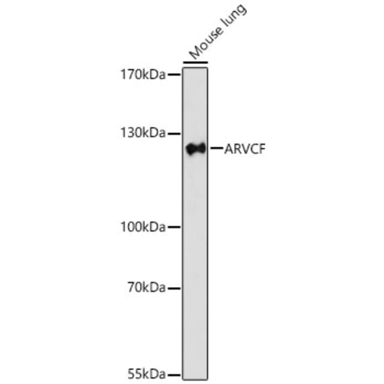 Western Blot - Anti-ARVCF Antibody (A329129) - Antibodies.com