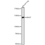 Western Blot - Anti-ARVCF Antibody (A329129) - Antibodies.com