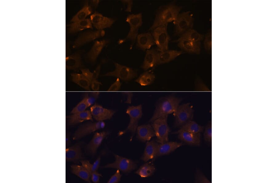 Immunofluorescence - Anti-ARVCF Antibody (A329129) - Antibodies.com