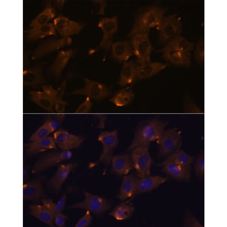 Immunofluorescence - Anti-ARVCF Antibody (A329129) - Antibodies.com