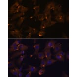 Immunofluorescence - Anti-ARVCF Antibody (A329129) - Antibodies.com