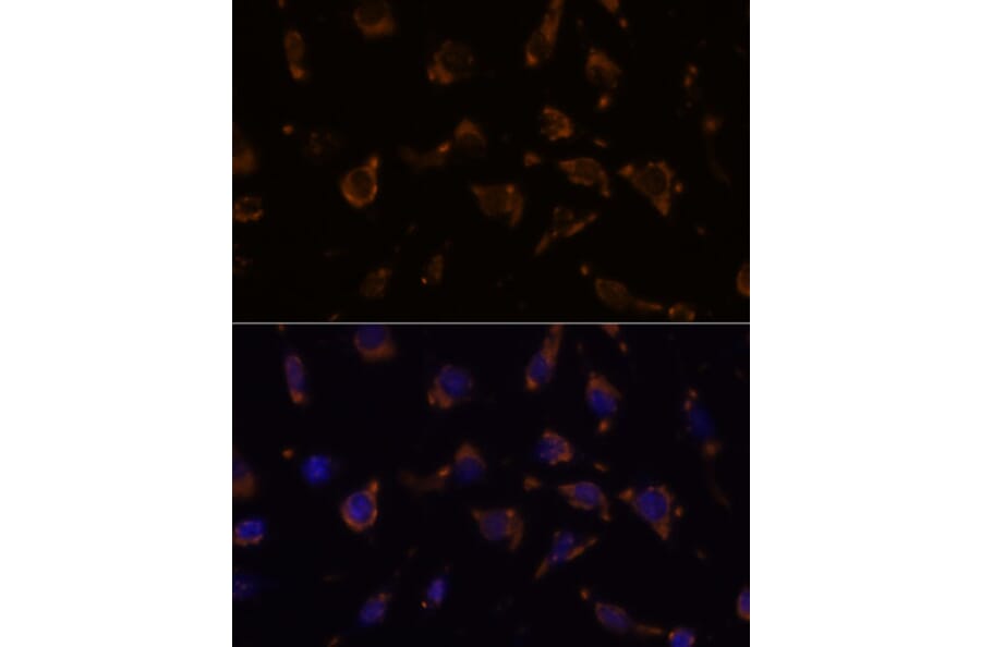 Immunofluorescence - Anti-ARVCF Antibody (A329129) - Antibodies.com
