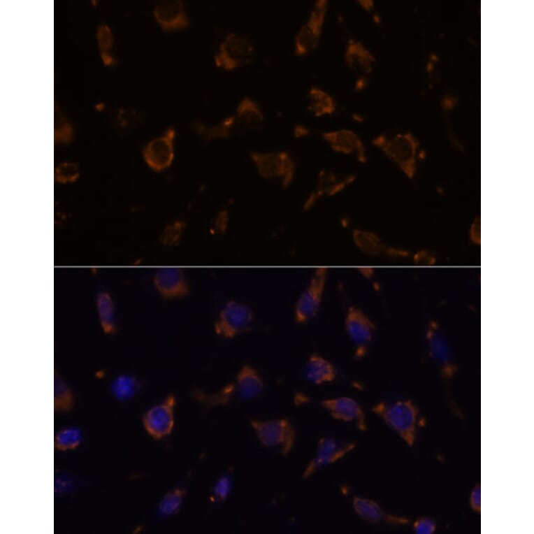 Immunofluorescence - Anti-ARVCF Antibody (A329129) - Antibodies.com
