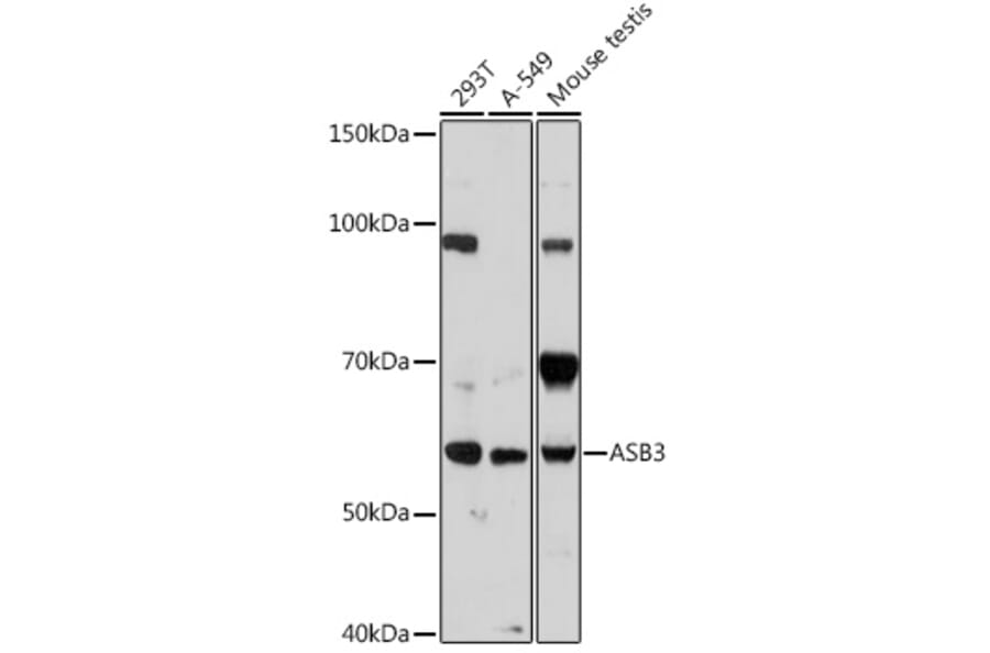 Western Blot - Anti-ASB3 Antibody (A329130) - Antibodies.com