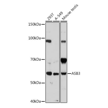 Western Blot - Anti-ASB3 Antibody (A329130) - Antibodies.com