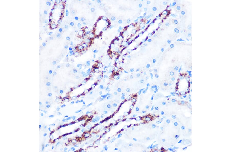 Immunohistochemistry - Anti-ASB3 Antibody (A329130) - Antibodies.com