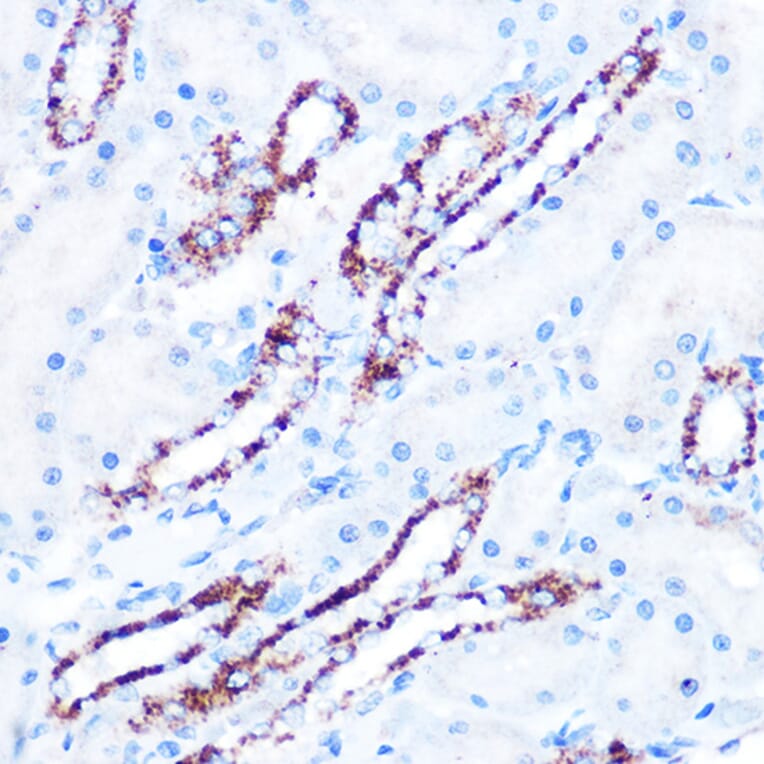 Immunohistochemistry - Anti-ASB3 Antibody (A329130) - Antibodies.com