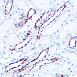 Immunohistochemistry - Anti-ASB3 Antibody (A329130) - Antibodies.com