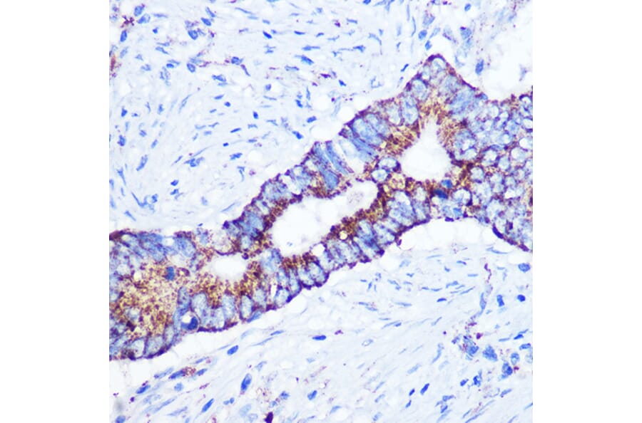 Immunohistochemistry - Anti-ASB3 Antibody (A329130) - Antibodies.com