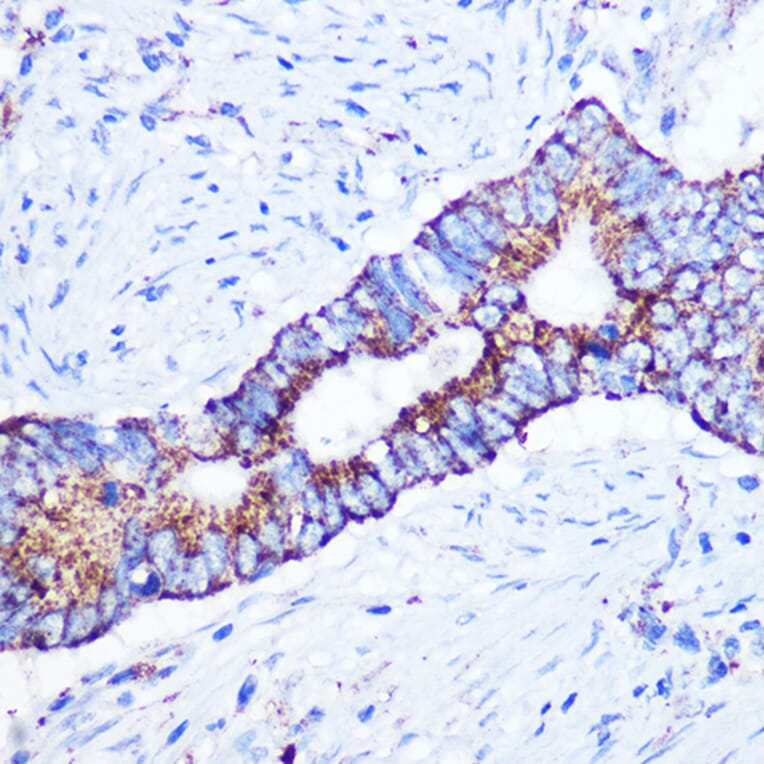 Immunohistochemistry - Anti-ASB3 Antibody (A329130) - Antibodies.com