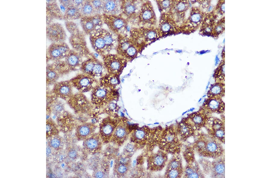Immunohistochemistry - Anti-ASB3 Antibody (A329130) - Antibodies.com