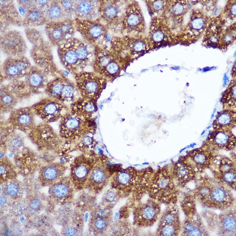 Immunohistochemistry - Anti-ASB3 Antibody (A329130) - Antibodies.com