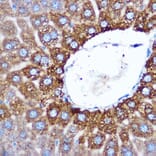 Immunohistochemistry - Anti-ASB3 Antibody (A329130) - Antibodies.com