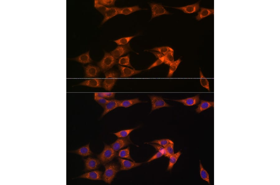 Immunofluorescence - Anti-ASB3 Antibody (A329130) - Antibodies.com